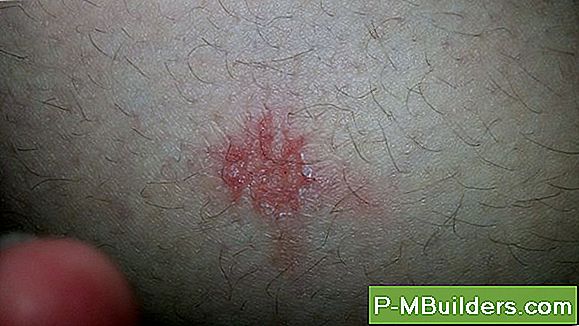Diagnose Eines Rasenmäher-Startproblems
